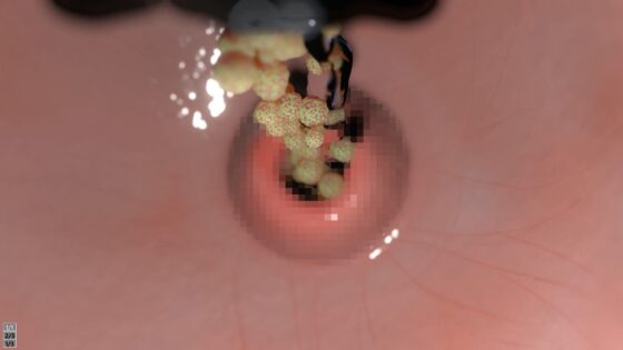 囚われた眼鏡っ子JK [湖畔の家] | DLsite 同人 - R18